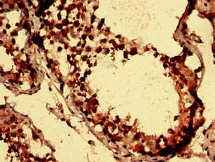 AXIN1 / Axin-1 Antibody