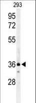 CCR1 Antibody (aa1-30)