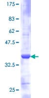 Human RPS21 / Ribosomal Protein S21 (Recombinant GST)