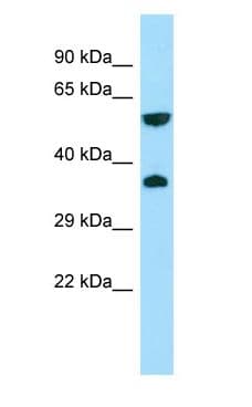 GPR22 Antibody (aa231-280)
