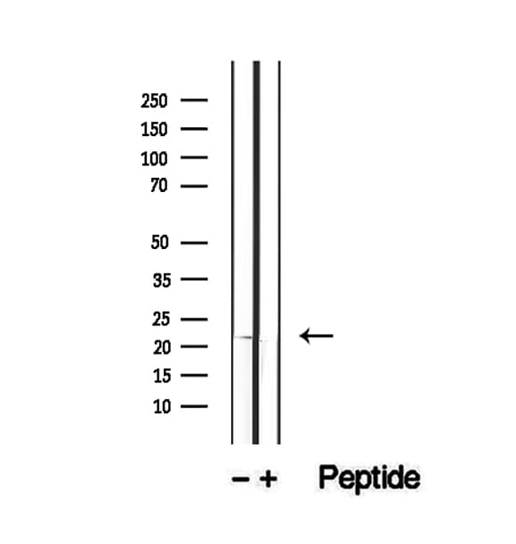 RBBP9 Antibody