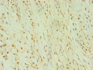BLK Antibody (aa1-280)