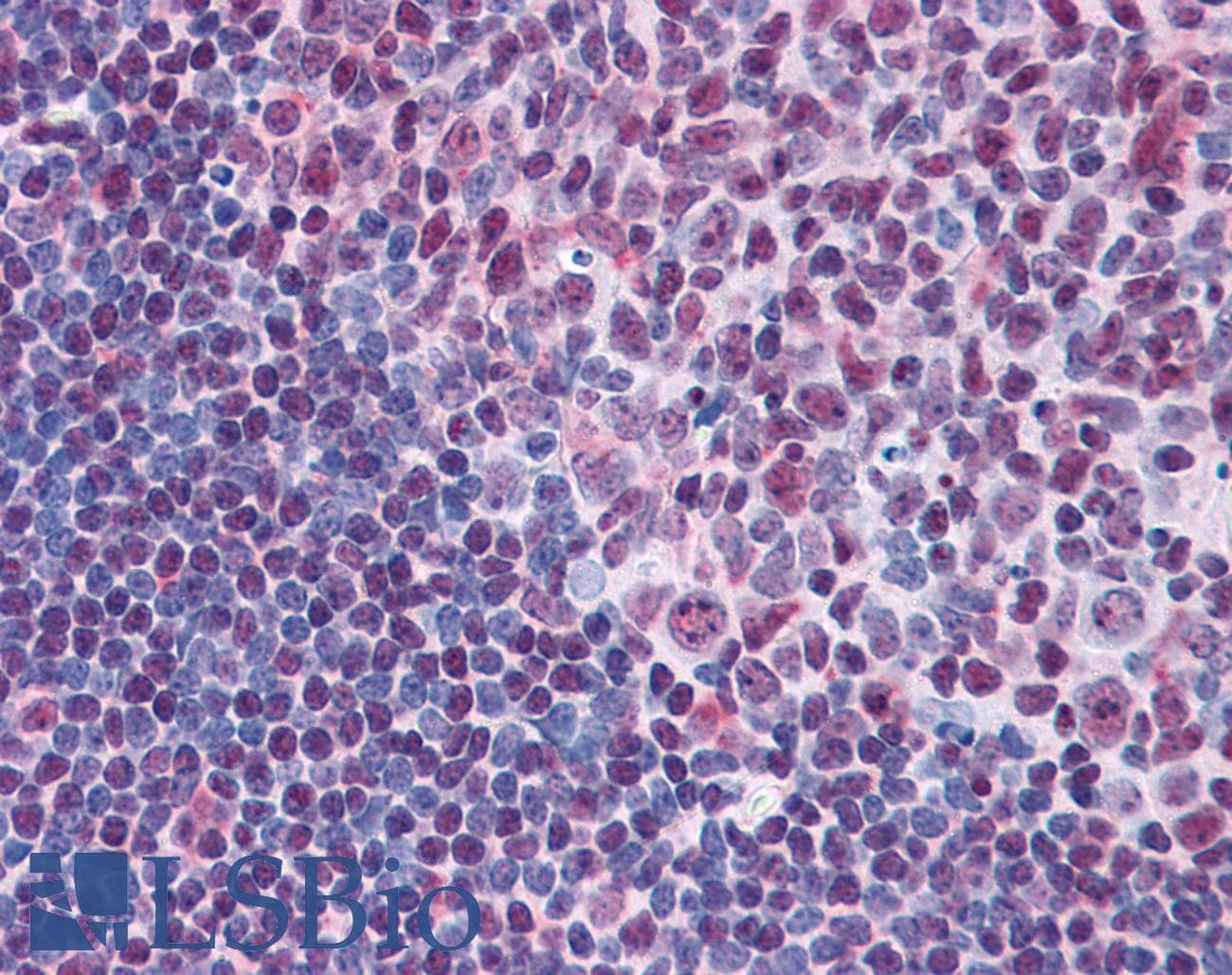 IHC-plus™ MYB / c-Myb Antibody (aa1-50)