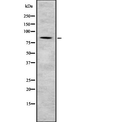 Polyclonal Rabbit anti-Human SEC23B Antibody (WB)