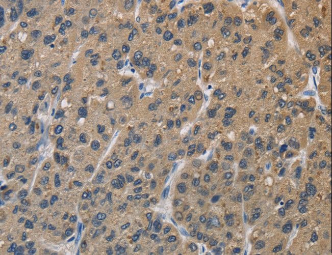 Polyclonal Rabbit anti-Human OPRS1 / SIGMAR1 Antibody (IHC, WB)