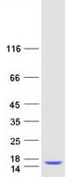 Human SH3BGRL3 Protein (Recombinant Myc-DDK (Flag))