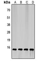 Polyclonal Rabbit anti-Human EIF4EBP1 / 4EBP1 Antibody (N-Terminus, IHC, IF, WB)