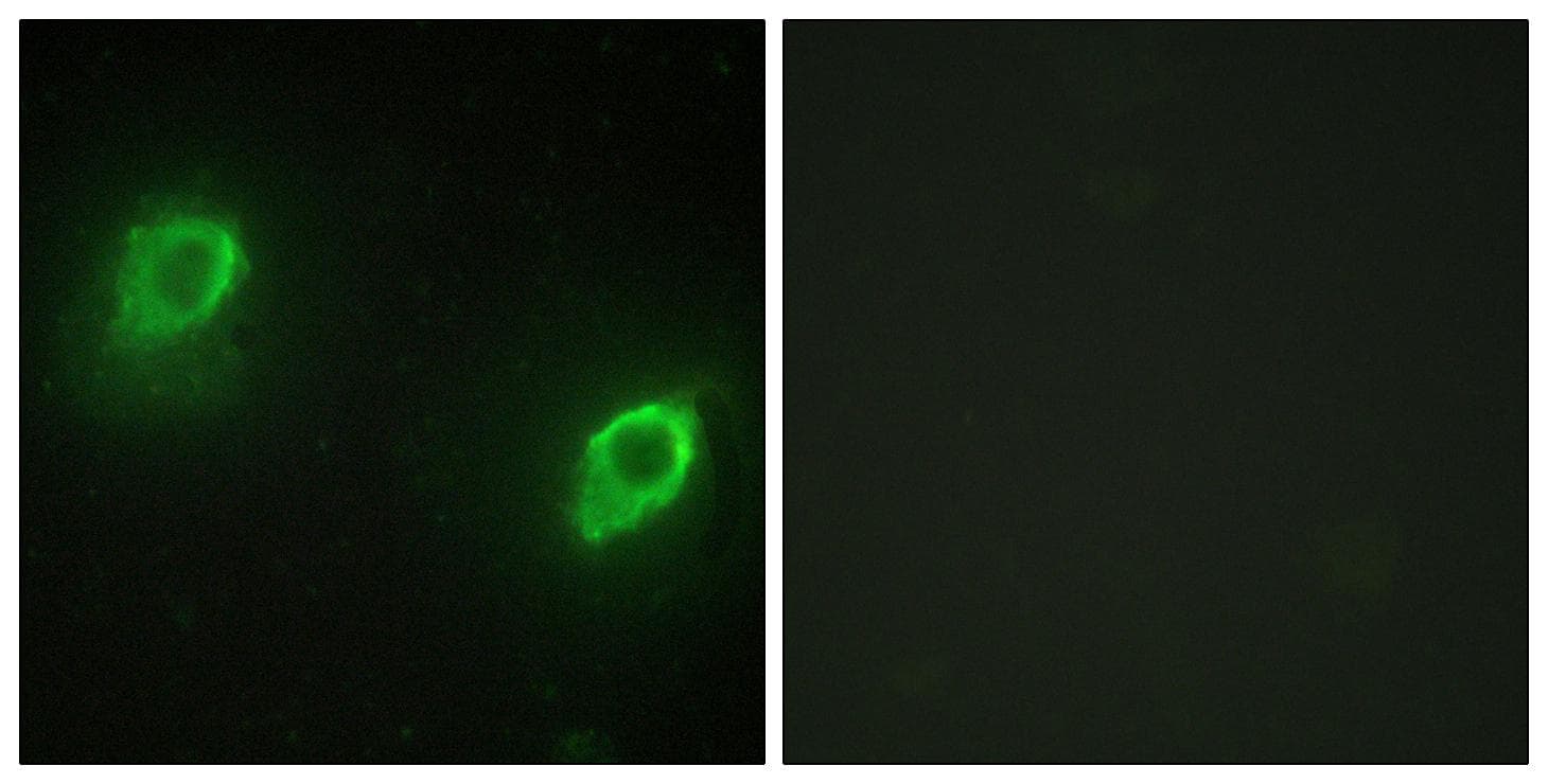 AKAP5 / AKAP79 Antibody