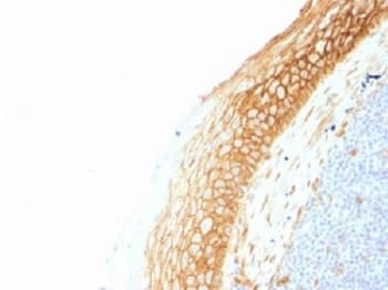 CTNNB1 / Beta Catenin Antibody (clone CTNNB1/1507)
