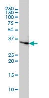 IHC-plus™ CCNH / Cyclin H Antibody (clone 1B8)