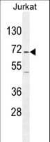 GAD65 Antibody (aa109-138)