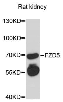 Polyclonal Rabbit anti-Human FZD5 / Frizzled 5 Antibody (WB)