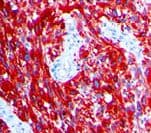 Monoclonal Mouse anti-Human MLANA / Melan-A Antibody (clone A103, IHC)