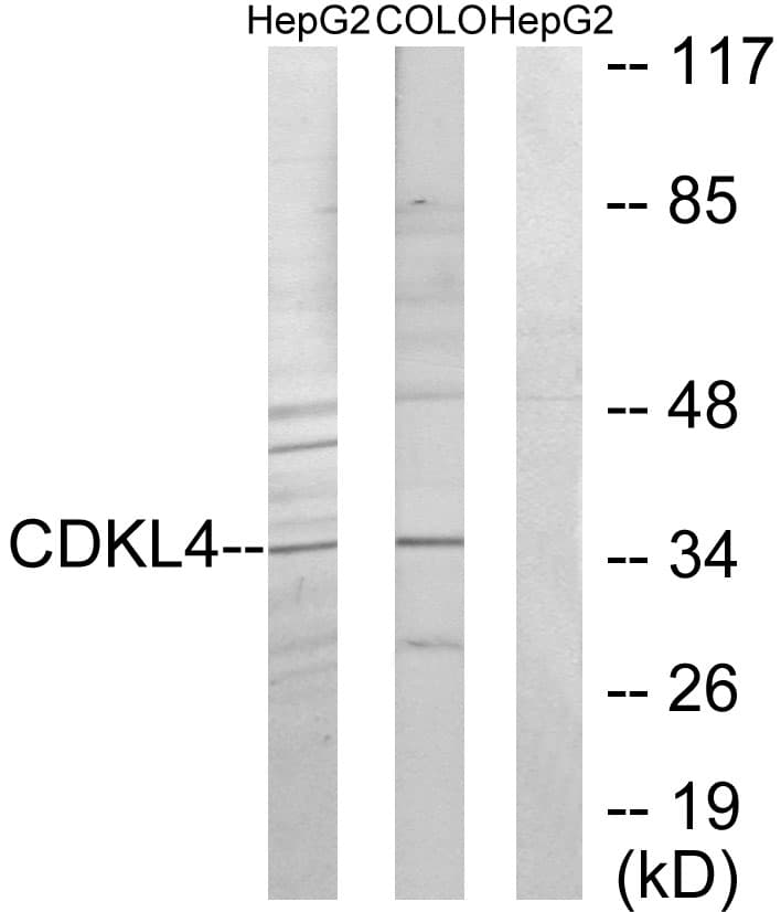 CDKL4 Antibody (aa266-315)