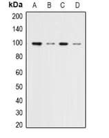 Polyclonal Rabbit anti-Human MAPK6 / ERK3 Antibody (IHC, WB)