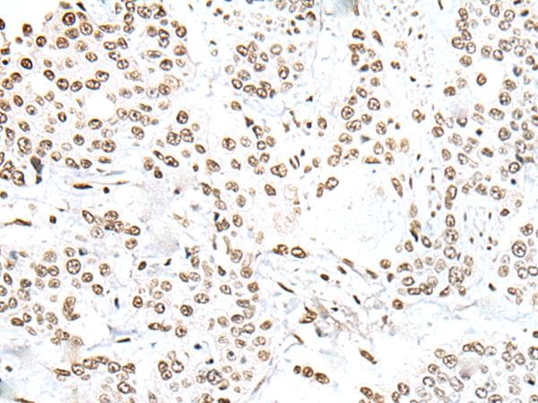 SNRPA / U1A Antibody