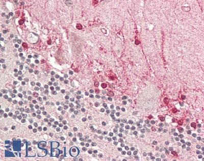 IHC-plus™ WWTR1 / TAZ Antibody