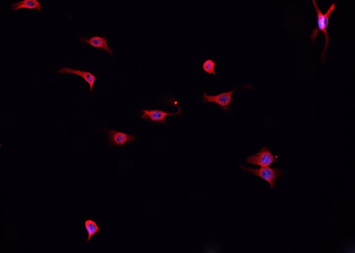 Polyclonal Rabbit anti-Human CTSK / Cathepsin K Antibody (IHC, IF, WB)