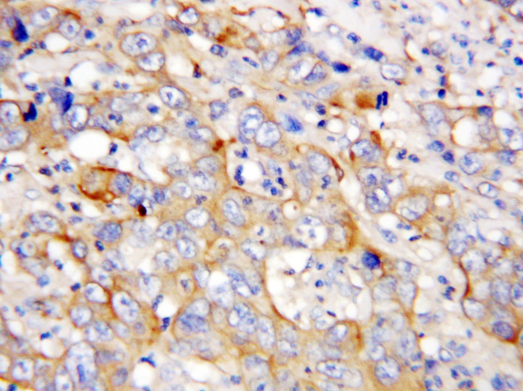 CXCL4 / PF4 Antibody (aa85-101)