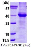 Human APP / Beta Amyloid Precursor Protein (Recombinant His)