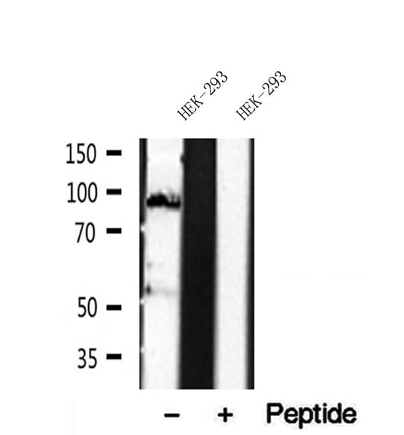 Polyclonal Rabbit anti-Human DACH / DACH1 Antibody (IHC, WB)