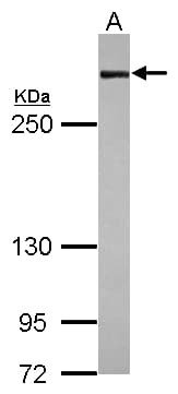 Polyclonal Rabbit anti-Human FLNA / Filamin A Antibody (N-Terminus, WB)