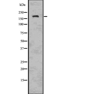 TRPM2 Antibody