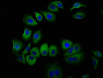 STRA6 Antibody (aa530-667)