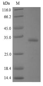 Human BPIFA2 / SPLUNC2 Protein (Recombinant)