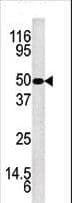 Polyclonal Rabbit anti-Human KLK5 / Kallikrein 5 Antibody (aa144-174, WB)
