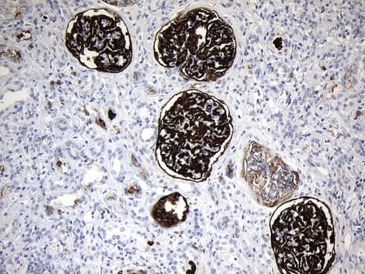 MME / CD10 Antibody (aa411-750, clone UMAB235)