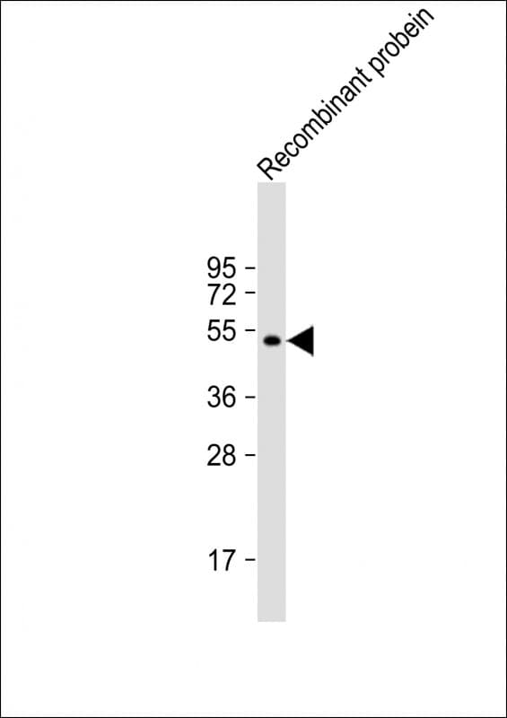 Monoclonal Mouse anti-Human LBC / AKAP13 Antibody (clone 1742CT411.87.24, WB)