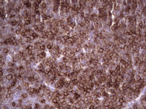 ANGPTL1 Antibody (aa24-491, clone OTI1B2, Carrier-free)