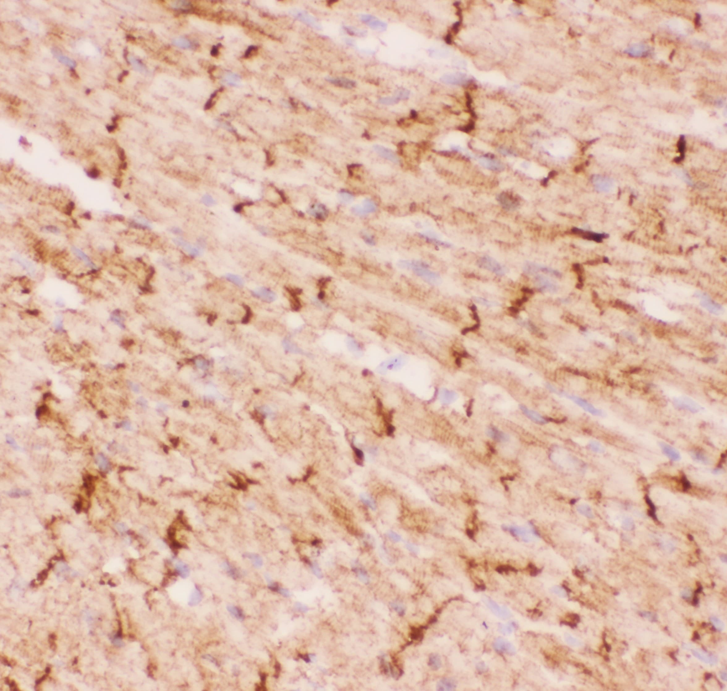 Polyclonal Rabbit anti-Human DES / Desmin Antibody (aa1-304, IHC, WB)