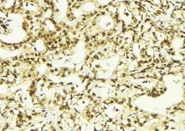 Polyclonal Rabbit anti-Human PCNA Antibody (IHC, IF, WB)