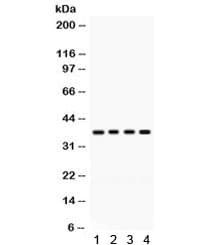 Polyclonal Rabbit anti-Human FOXA3 Antibody (WB)