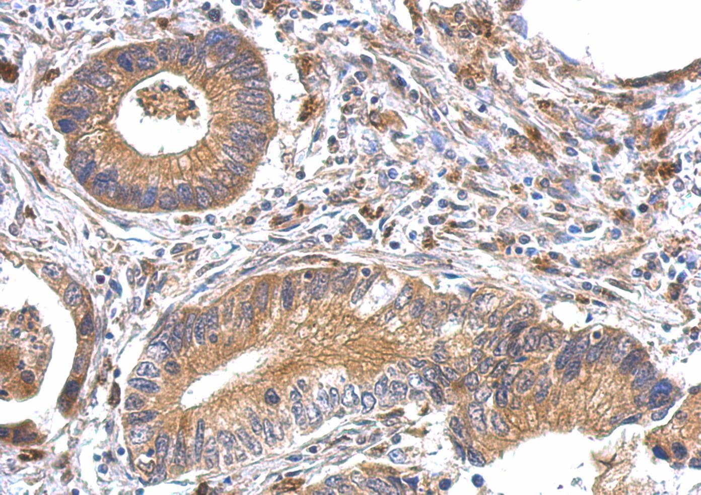OFD1 Antibody (aa136-417)