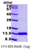 Human Calgizzarin / S100A11 Protein (Recombinant His)