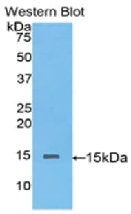 BGN / Biglycan Antibody (aa53-166)