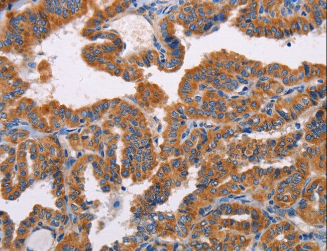 ALG9 Antibody