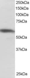 IHC-plus™ PTBP1 Antibody (aa2-14)