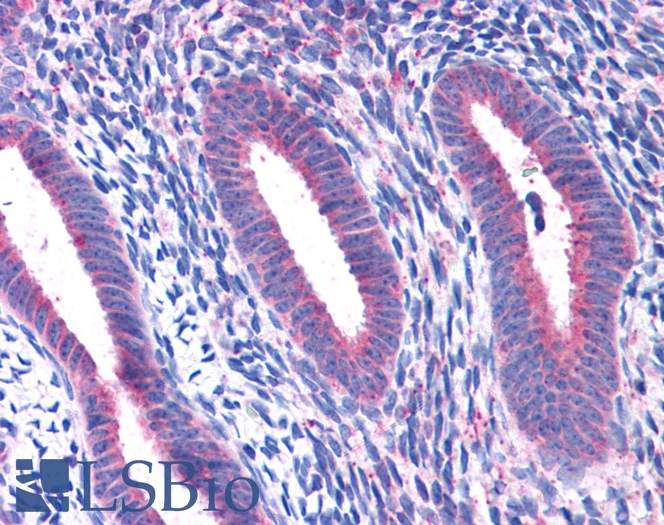 IHC-plus™ RPL22 / Ribosomal Protein L22 Antibody (aa106-119)