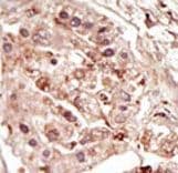 Polyclonal Rabbit anti-Human STK31 Antibody (aa987-1018, IHC, WB)