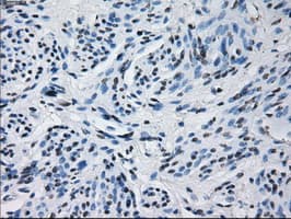 PRL / Prolactin Antibody (clone OTI6B1, Carrier-free)