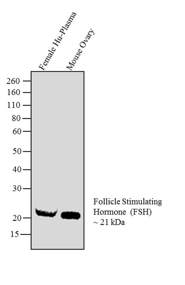 FSH Antibody (clone P2B4)