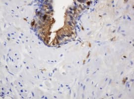 TP / Thymidine Phosphorylase Antibody (aa311-482, clone 7A6, Carrier-free)