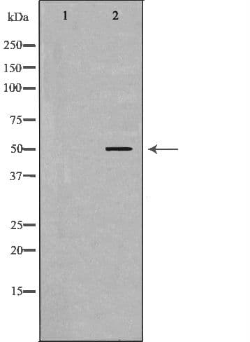 NR1H3 / LXR Alpha Antibody