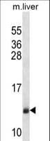 Polyclonal Rabbit anti-Human SEC61B Antibody (aa42-70, IHC, WB)