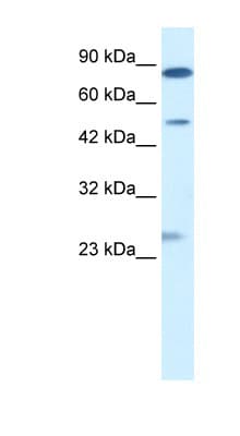 CLIC6 Antibody (aa435-484)