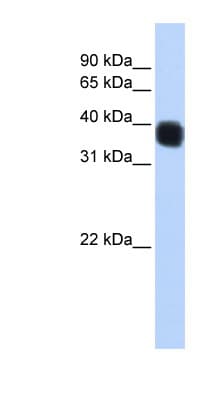 SSDP1 / SSBP3 Antibody (C-Terminus)